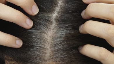 Photo of خلطات طبيعية لانبات الشعر الخفيف في مقدمة الرأس