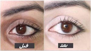 علاج الهالات السوداء بوصفات من زيت اللوز