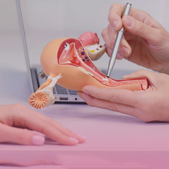 علاج تاخر الحمل بالمنظار