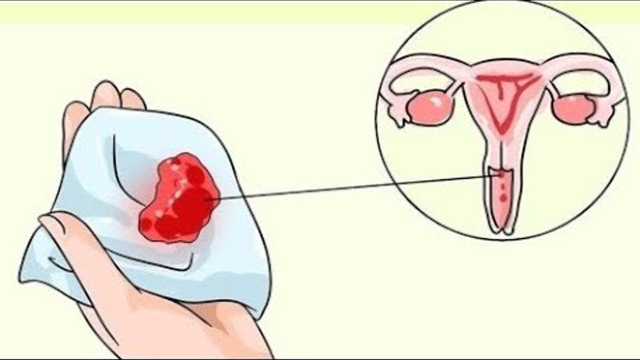 مشاكل صحية تكشفها لك الدورة الشهرية