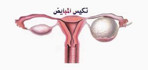 وصفات لعلاج تاخر الحمل وضعف المبايض وهرمون الحليب