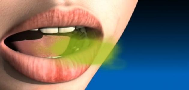 علامات السموم في جسمك وكيفية تنظيف الجسم من السموم