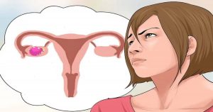 أسباب وأعراض تكيس المبايض وطرق علاجها