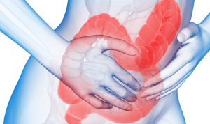 اعراض القولون العصبي وأسبابه وطرق علاجه
