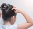 قمل الراس عند الاطفال