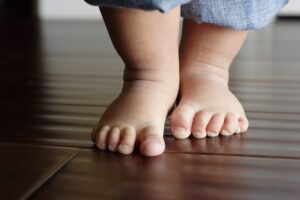 الفلات فوت عند الاطفال وأنواعه وطرق العلاج