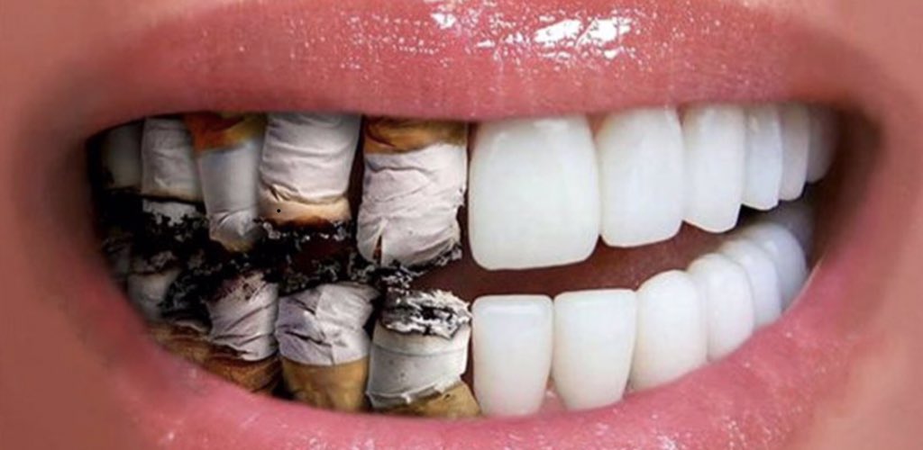 مخاطر و اضرار التدخين على الفم والاسنان