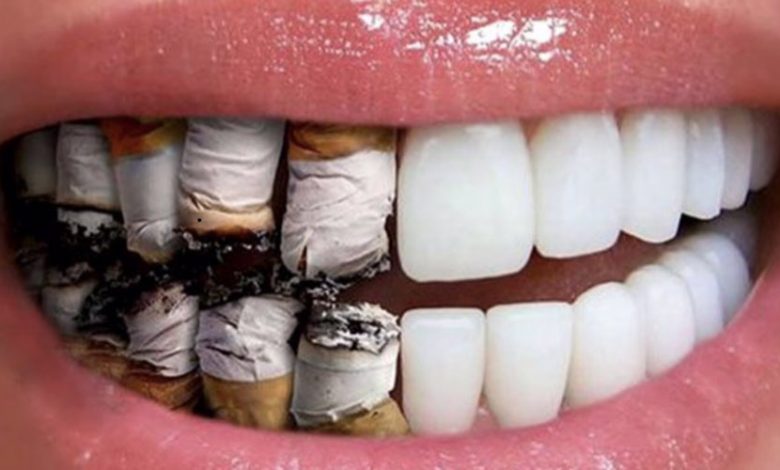 مخاطر و اضرار التدخين على الفم والاسنان