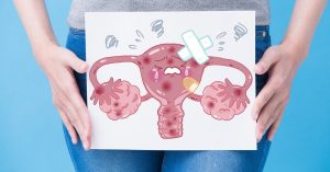 أسباب ضعف التبويض وتاخر الانجاب وخطوات العلاج