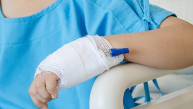 الحروق عند الاطفال بالسوائل الساخنة وكيفية علاجها