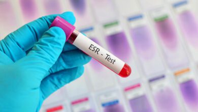 ما هي سرعة الترسيب عند الاطفال ؟