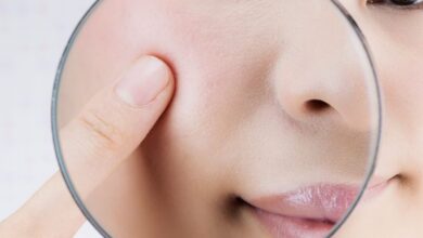 طريقة للتخلص من المسام الواسعة