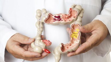 اعراض الزائدة الدودية