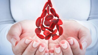جلطات الاوردة والشرايين وطرق الوقاية من الإصابة بها