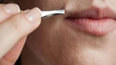 مشاكل نمو الشعر الزائد عند البنات و السيدات و مرض تكيس المبايض