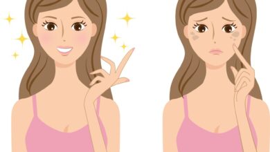 علاج مشاكل البشرة