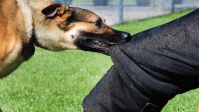 الاسعافات الاولية للحروق