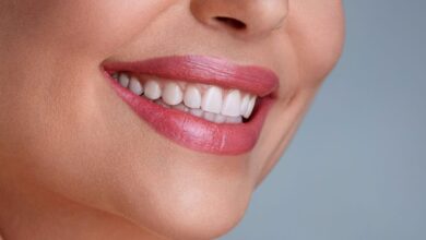 السواد حول الفم